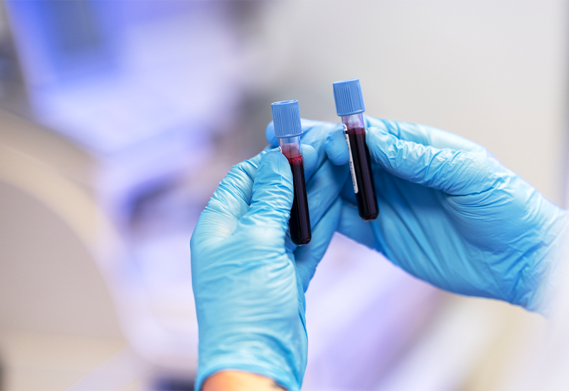 Liquid biopsy